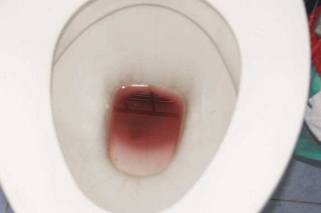 spotten bij mannen wanneer ze opgewonden zijn